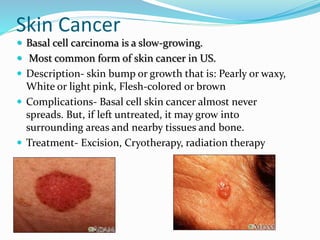 Skin Cancer
 Basal cell carcinoma is a slow-growing.
 Most common form of skin cancer in US.
 Description- skin bump or growth that is: Pearly or waxy,
White or light pink, Flesh-colored or brown
 Complications- Basal cell skin cancer almost never
spreads. But, if left untreated, it may grow into
surrounding areas and nearby tissues and bone.
 Treatment- Excision, Cryotherapy, radiation therapy
 