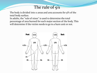 The rule of 9’s
The body is divided into 11 areas and area accounts for 9% of the
total body surface.
In adults, the "rule of nines" is used to determine the total
percentage of area burned for each major section of the body. This
will determine if the victim needs to go to a burn unit or not.
 
