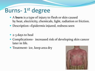 Burns- 1st degree
 A burn is a type of injury to flesh or skin caused
by heat, electricity, chemicals, light, radiation or friction.
 Description =Epidermis injured, redness seen
 2-3 days to heal
 Complications- increased risk of developing skin cancer
later in life.
 Treatment- ice, keep area dry
 