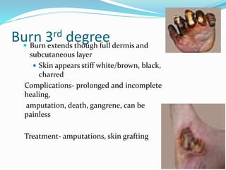 Burn 3rd degree Burn extends though full dermis and
subcutaneous layer
 Skin appears stiff white/brown, black,
charred
Complications- prolonged and incomplete
healing,
amputation, death, gangrene, can be
painless
Treatment- amputations, skin grafting
 