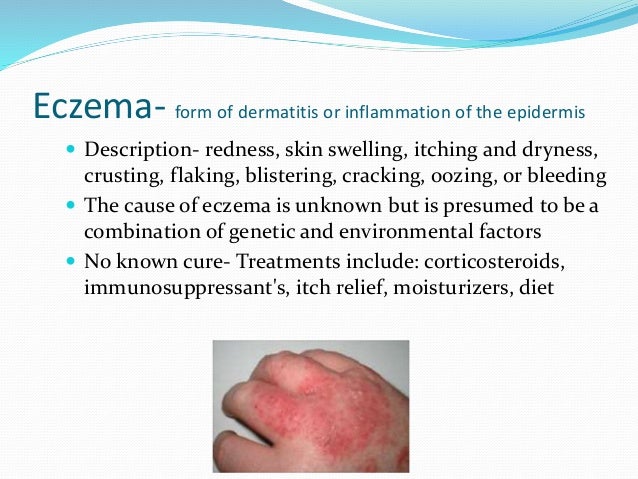 Integumentary disorders
