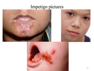 Invatago Integumentary disorders.ppt