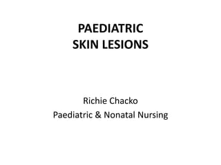 PAEDIATRIC
SKIN LESIONS
Richie Chacko
Paediatric & Nonatal Nursing
 