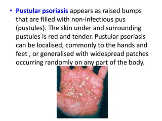Infectious Pustular Rash Integumentary disorders 2 | PPTX