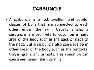 Carbuncle Back Cas Integumentary disorders 3 | PPTX