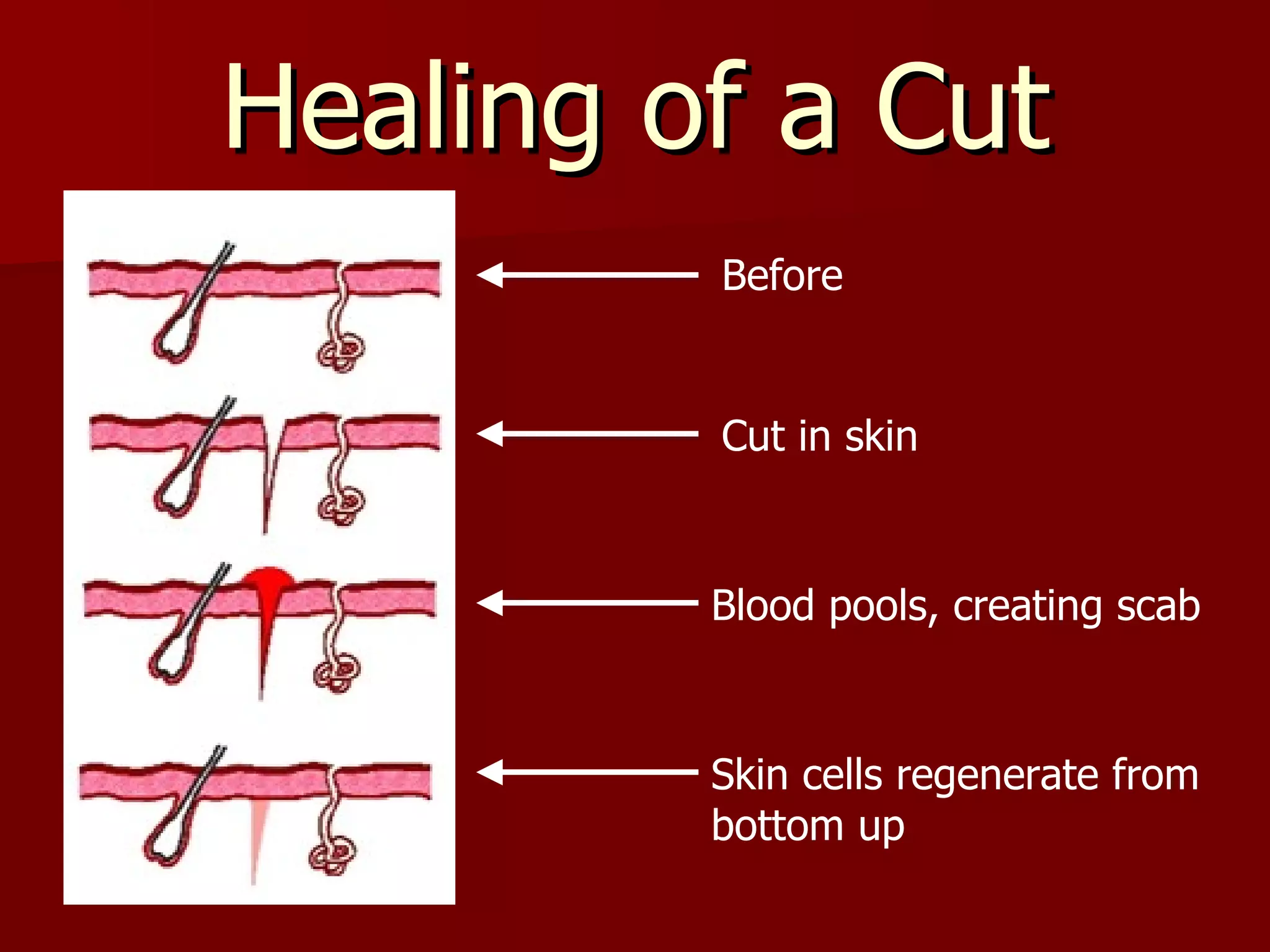 Healing of a Cut Before  Cut in skin Blood pools, creating scab Skin cells regenerate from bottom up 