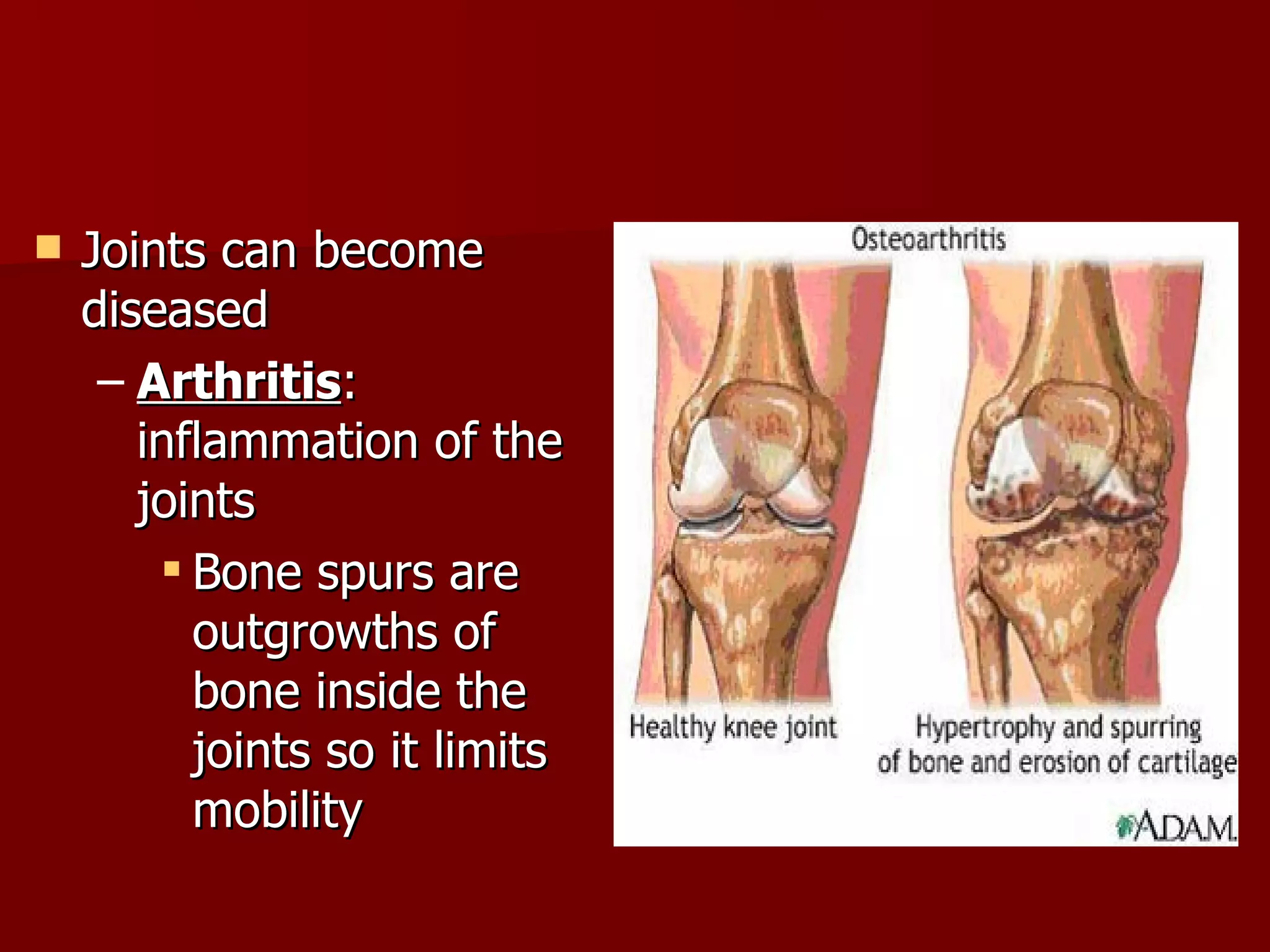 Joints can become diseased Arthritis : inflammation of the joints Bone spurs are outgrowths of bone inside the joints so it limits mobility  