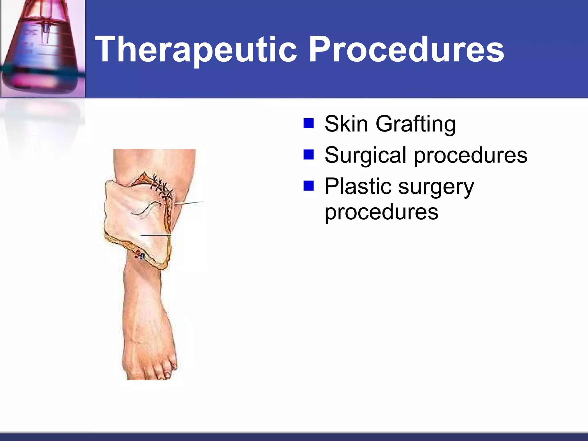 Therapeutic Procedures Skin Grafting Surgical procedures Plastic surgery procedures 