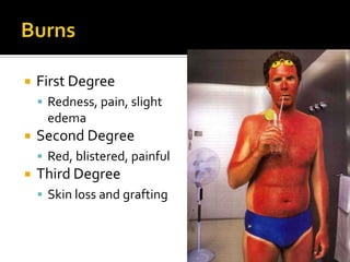 Exocrine glands of the skinSebaceousSebumOily, waxy secretion
