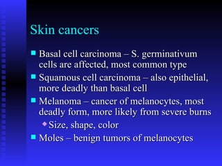 Skin cancers Basal cell carcinoma – S. germinativum cells are affected, most common type Squamous cell carcinoma – also epithelial, more deadly than basal cell Melanoma – cancer of melanocytes, most deadly form, more likely from severe burns Size, shape, color Moles – benign tumors of melanocytes 