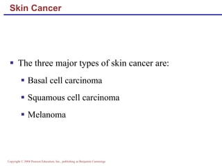Skin Cancer The three major types of skin cancer are: Basal cell carcinoma Squamous cell carcinoma Melanoma 