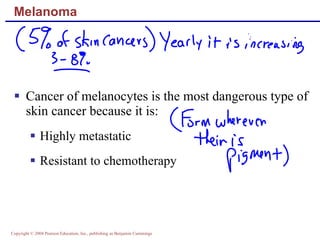 Melanoma Cancer of melanocytes is the most dangerous type of skin cancer because it is: Highly metastatic Resistant to chemotherapy 