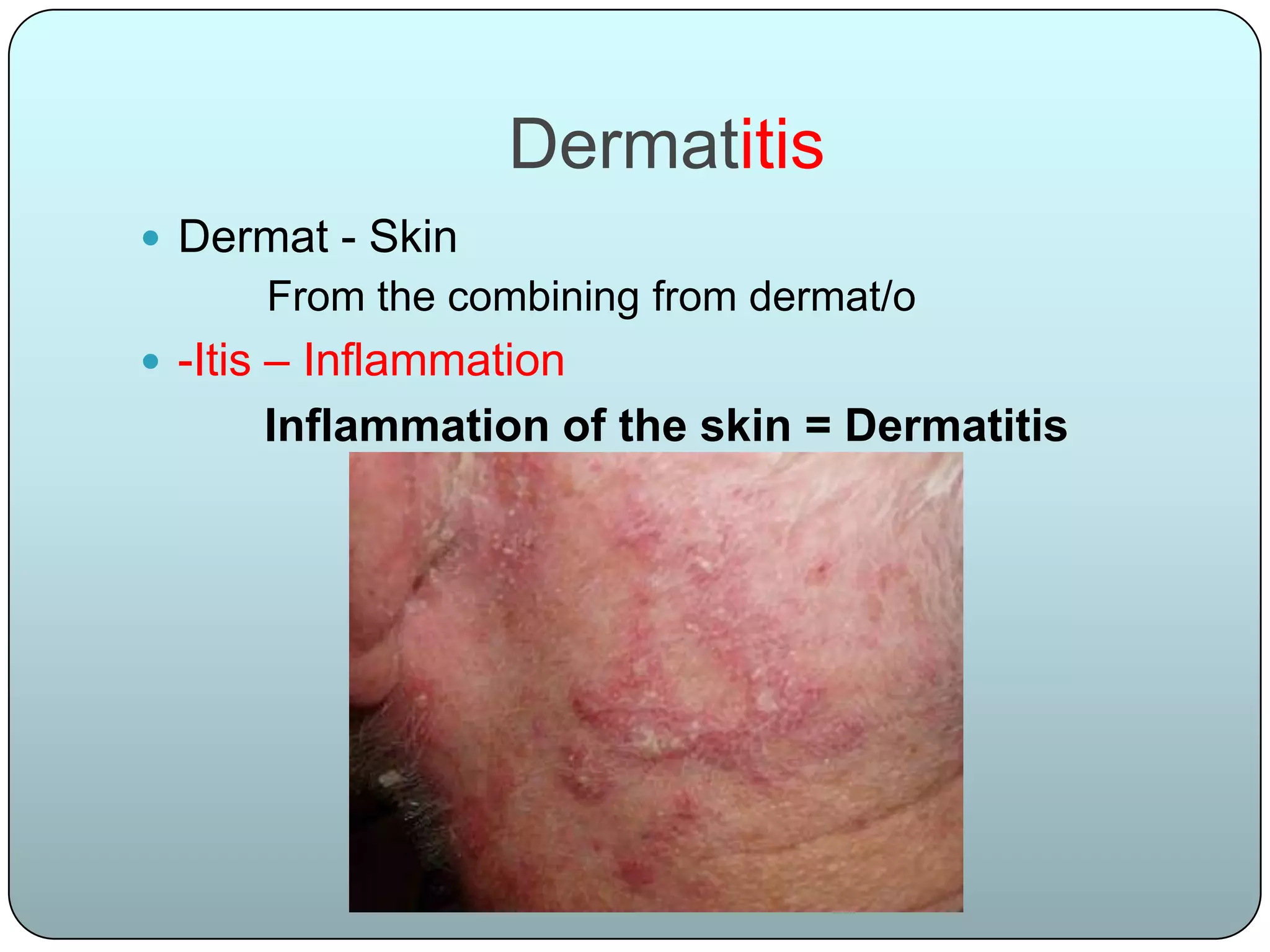 Dermatitis
 Dermat - Skin
      From the combining from dermat/o
 -Itis – Inflammation
      Inflammation of the skin = Dermatitis
 