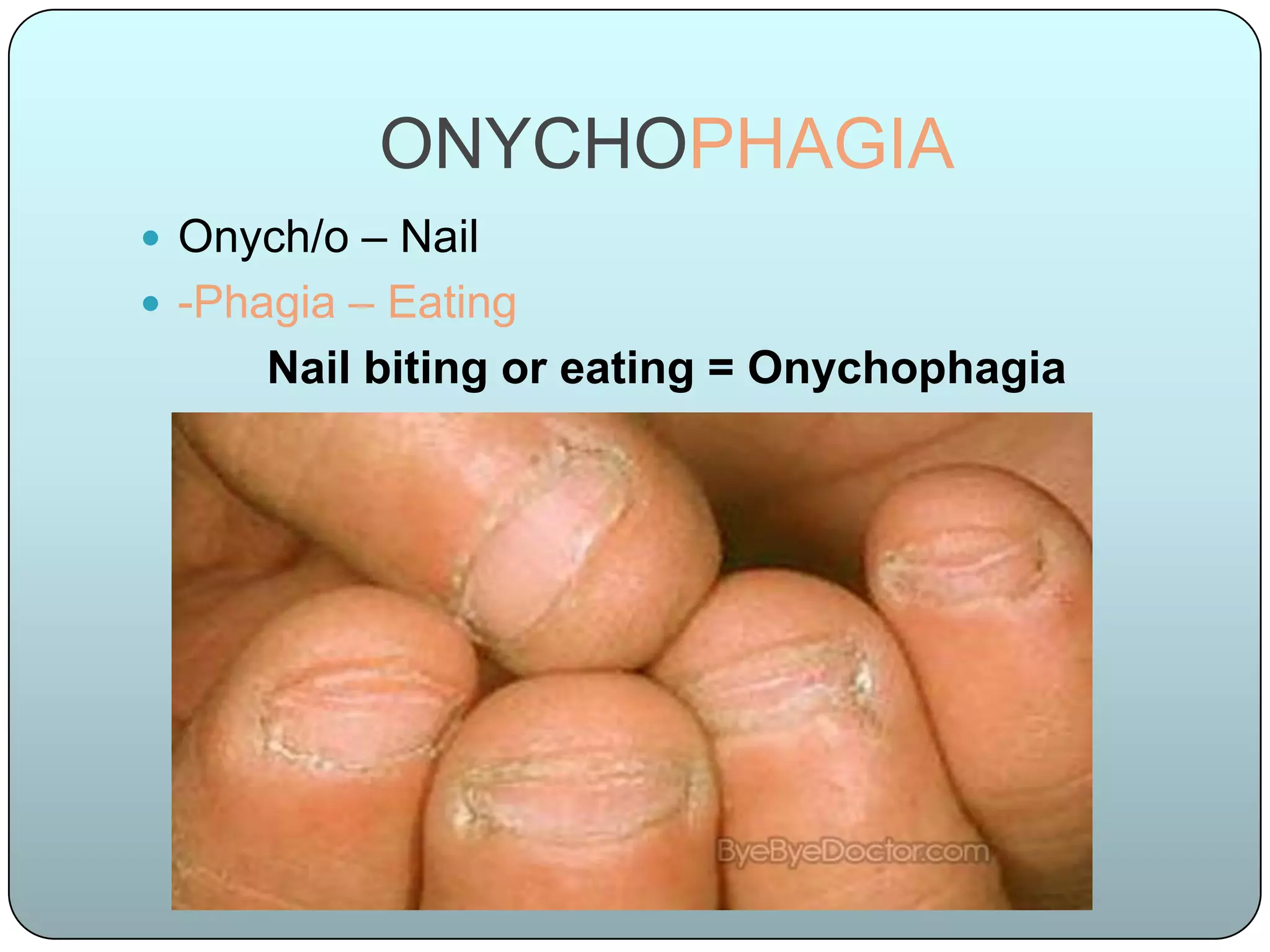 ONYCHOPHAGIA
 Onych/o – Nail
 -Phagia – Eating
      Nail biting or eating = Onychophagia
 