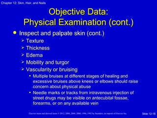 Chapter 1122:: SSkkiinn,, HHaaiirr,, aanndd NNaaiillss 
OObbjjeeccttiivvee DDaattaa:: 
PPhhyyssiiccaall EExxaammiinnaattiioonn ((ccoonntt..)) 
 IInnssppeecctt aanndd ppaallppaattee sskkiinn ((ccoonntt..)) 
 TTeexxttuurree 
 TThhiicckknneessss 
 EEddeemmaa 
 MMoobbiilliittyy aanndd ttuurrggoorr 
 VVaassccuullaarriittyy oorr bbrruuiissiinngg 
• MMuullttiippllee bbrruuiisseess aatt ddiiffffeerreenntt ssttaaggeess ooff hheeaalliinngg aanndd 
eexxcceessssiivvee bbrruuiisseess aabboovvee kknneeeess oorr eellbboowwss sshhoouulldd rraaiissee 
ccoonncceerrnn aabboouutt pphhyyssiiccaall aabbuussee 
• NNeeeeddllee mmaarrkkss oorr ttrraacckkss ffrroomm iinnttrraavveennoouuss iinnjjeeccttiioonn ooff 
ssttrreeeett ddrruuggss mmaayy bbee vviissiibbllee oonn aanntteeccuubbiittaall ffoossssaaee,, 
ffoorreeaarrmmss,, oorr oonn aannyy aavvaaiillaabbllee vveeiinn 
Elsevier items and derived items © 2012, 2008, 2004, 2000, 1996, 1992 by Saunders, an imprint of Elsevier Inc. 
Slide 12-18 
 