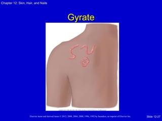 Chapter 1122:: SSkkiinn,, HHaaiirr,, aanndd NNaaiillss 
GGyyrraattee 
Elsevier items and derived items © 2012, 2008, 2004, 2000, 1996, 1992 by Saunders, an imprint of Elsevier Inc. 
Slide 12-27 
 
