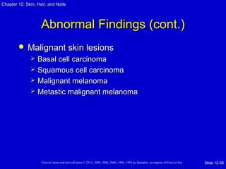 Chapter 1122:: SSkkiinn,, HHaaiirr,, aanndd NNaaiillss 
AAbbnnoorrmmaall FFiinnddiinnggss ((ccoonntt..)) 
 MMaalliiggnnaanntt sskkiinn lleessiioonnss 
 BBaassaall cceellll ccaarrcciinnoommaa 
 SSqquuaammoouuss cceellll ccaarrcciinnoommaa 
 MMaalliiggnnaanntt mmeellaannoommaa 
 MMeettaassttiicc mmaalliiggnnaanntt mmeellaannoommaa 
Elsevier items and derived items © 2012, 2008, 2004, 2000, 1996, 1992 by Saunders, an imprint of Elsevier Inc. 
Slide 12-58 
 