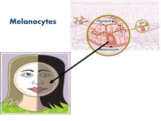 Melanocytes