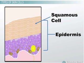Epidermis
Squamous
Cell