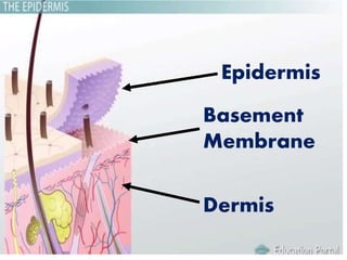 Epidermis
Dermis
Basement
Membrane