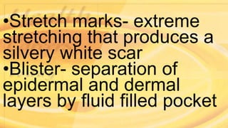 •Stretch marks- extreme
stretching that produces a
silvery white scar
•Blister- separation of
epidermal and dermal
layers by fluid filled pocket
 