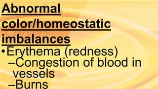 Abnormal
color/homeostatic
imbalances
•Erythema (redness)
–Congestion of blood in
vessels
–Burns
 
