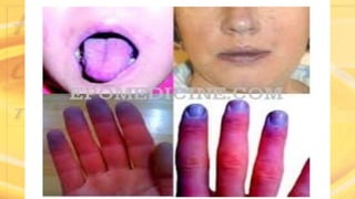 Copyright 2003 by Mosby, Inc. All rights
reserved.
 