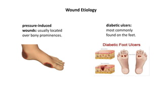 Wound Etiology
pressure‐induced
wounds: usually located
over bony prominences.
diabetic ulcers:
most commonly
found on the feet.
 
