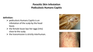 Parasitic Skin Infestation
Pediculosis Humans Capitis
definition:
 pediculosis Humans Capitis is an
infestation of the scalp by the head
louse.
 the female louse lays her eggs (nits)
close to the scalp.
 the transmission is strictly interhuman.
 