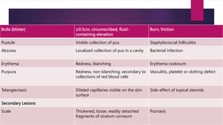Bulla (blister) ≥0.5cm, circumscribed, fluid-
containing elevation
Burn, friction
Pustule Visible collection of pus Staphylococcal folliculitis
Abscess Localised collection of pus in a cavity Bacterial infection
Erythema Redness, blanching Erythema nodosum
Purpura Redness, non-blanching, secondary to
collections of red blood cells
Vasculitis, platelet or clotting defect
Telangiectasis Dilated capillaries visible on the skin
surface
Side-effect of topical steroids
Secondary Lesions
Scale Thickened, loose, readily detached
fragments of stratum corneum
Psoriasis
 