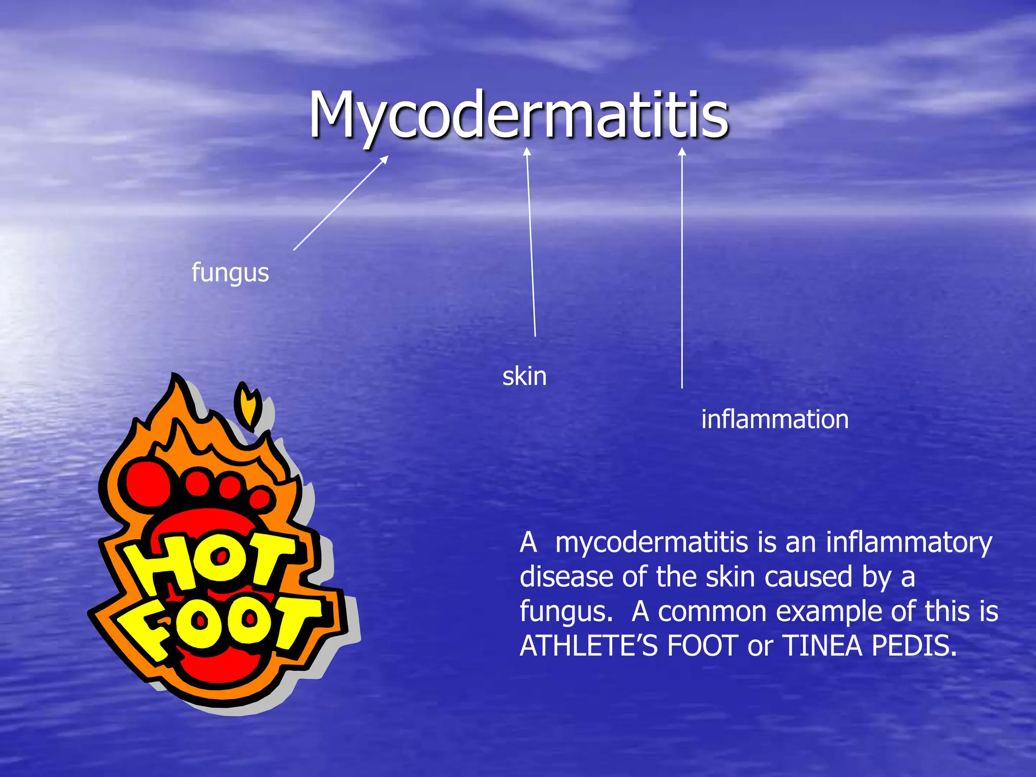 Mycodermatitis
inflammation
skin
fungus
A mycodermatitis is an inflammatory
disease of the skin caused by a
fungus. A common example of this is
ATHLETE’S FOOT or TINEA PEDIS.
 