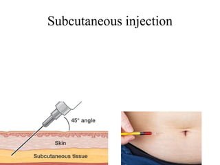 Subjunct Injection Integumentary system -mbbs.pptx