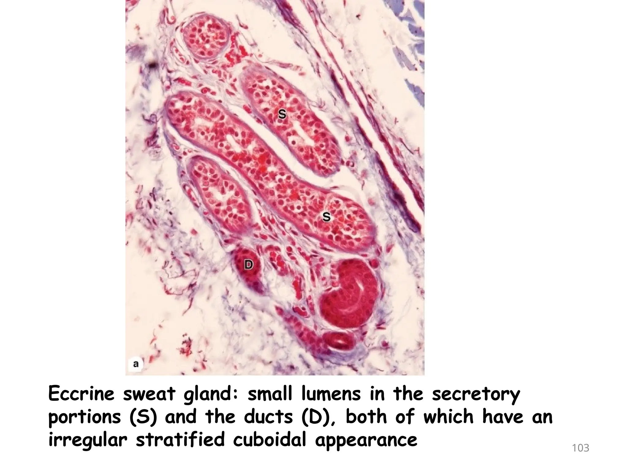 Eccrine sweat gland: small lumens in the secretory
portions (S) and the ducts (D), both of which have an
irregular stratified cuboidal appearance 103
 