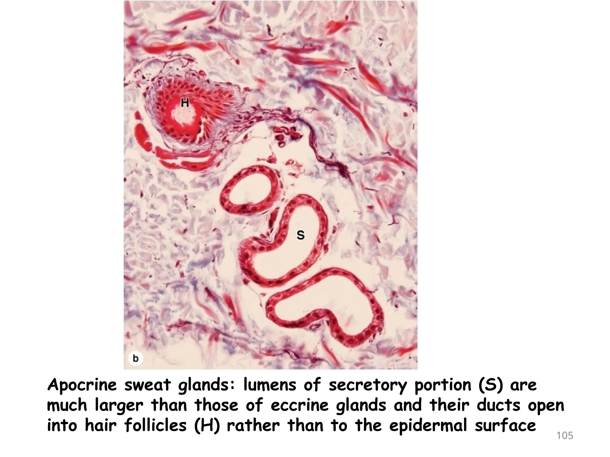 Apocrine sweat glands: lumens of secretory portion (S) are
much larger than those of eccrine glands and their ducts open
into hair follicles (H) rather than to the epidermal surface 105
 