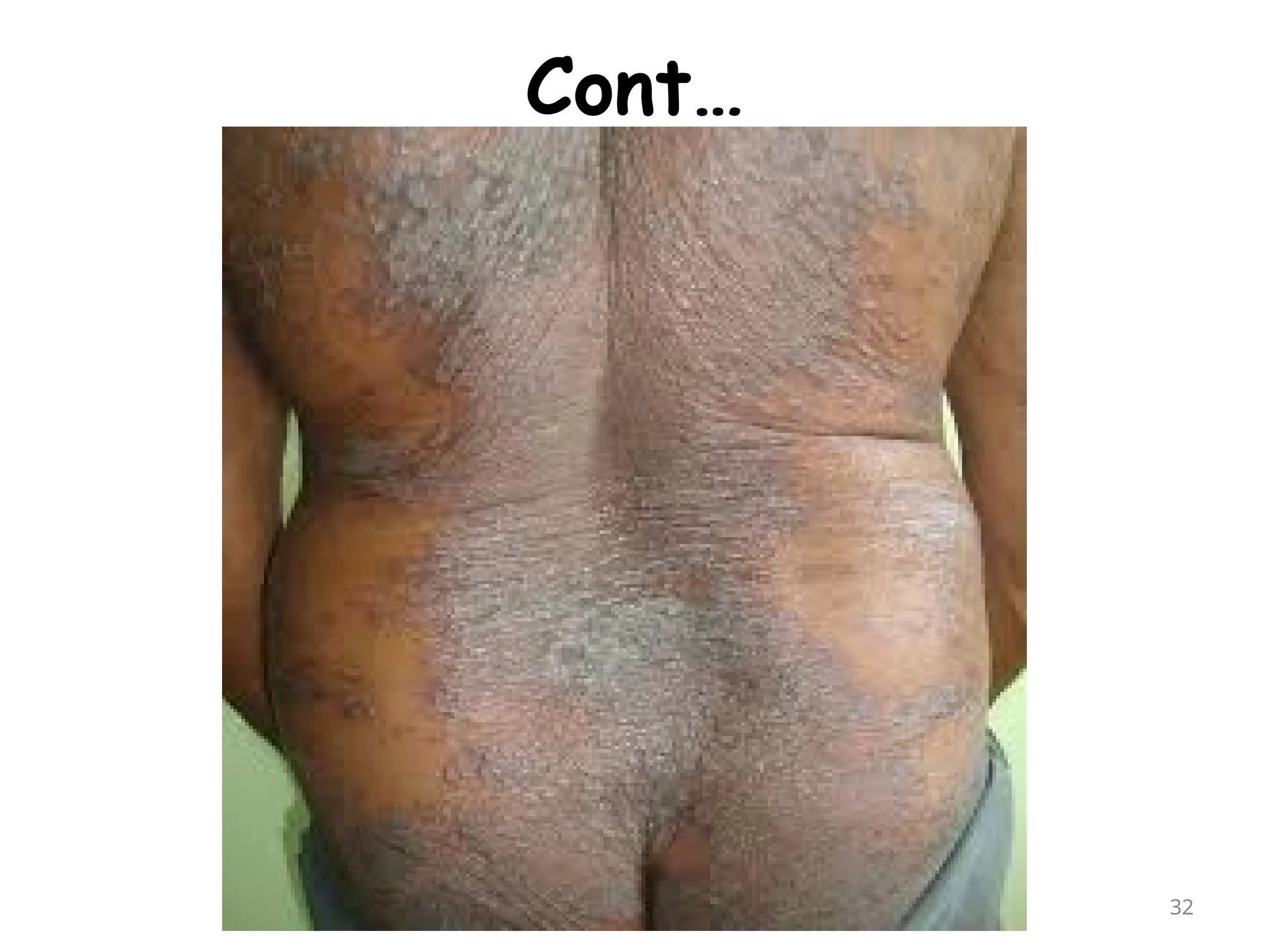 Cont…
32
 