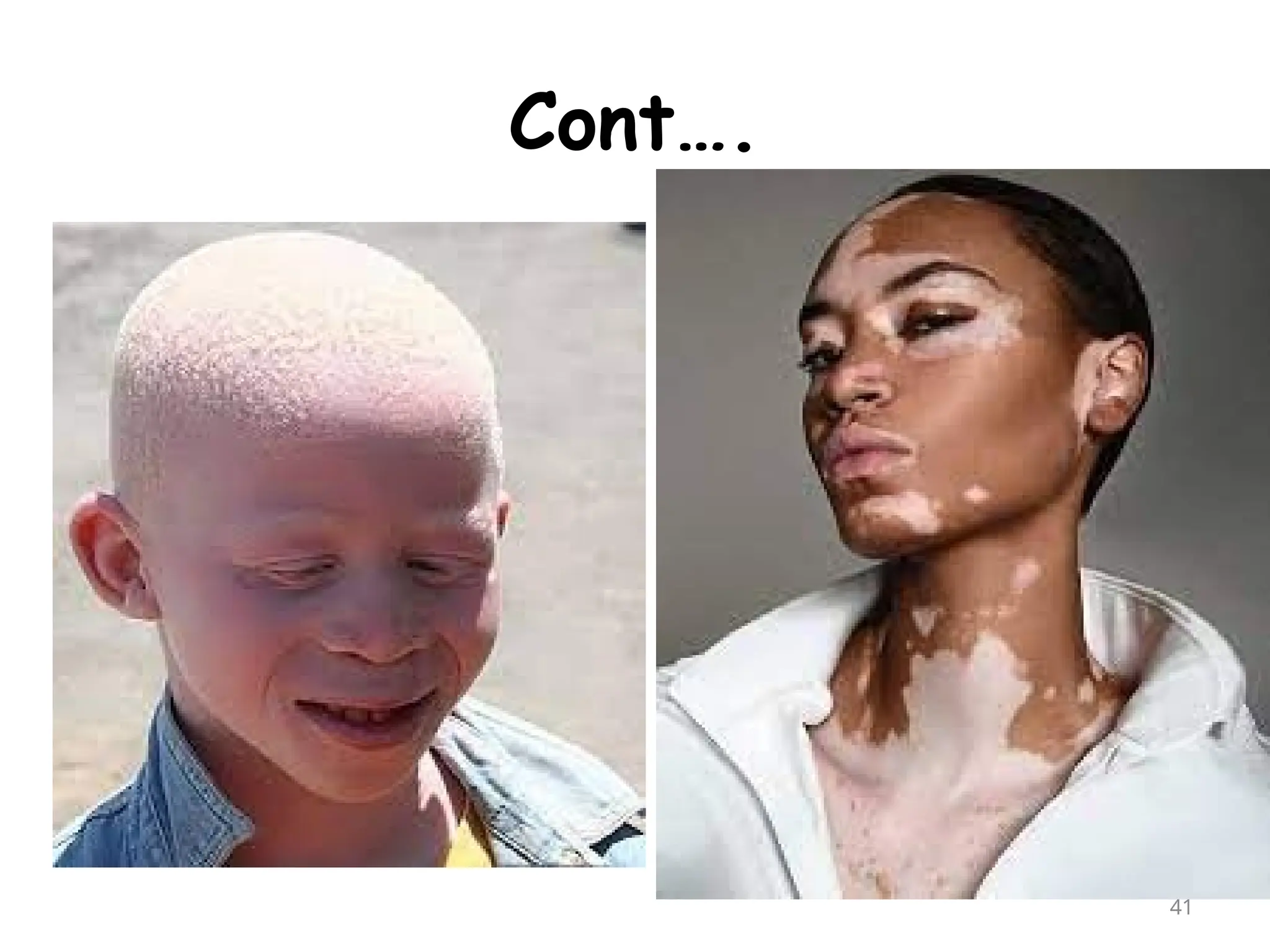 Cont….
41
 