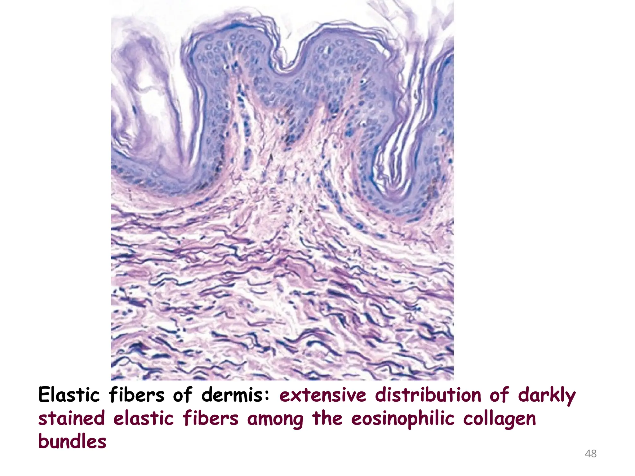 Elastic fibers of dermis: extensive distribution of darkly
stained elastic fibers among the eosinophilic collagen
bundles 48
 