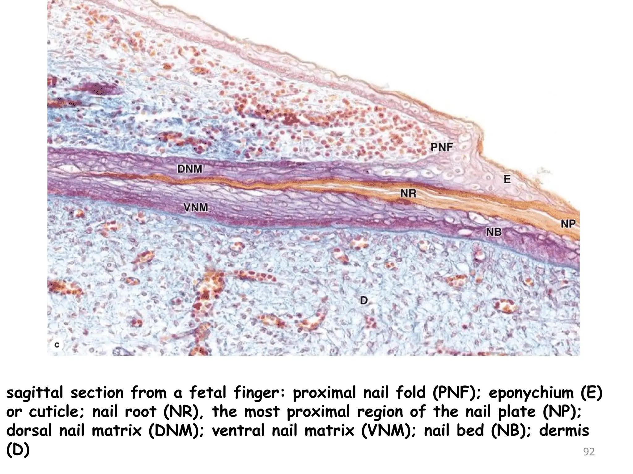 sagittal section from a fetal finger: proximal nail fold (PNF); eponychium (E)
or cuticle; nail root (NR), the most proximal region of the nail plate (NP);
dorsal nail matrix (DNM); ventral nail matrix (VNM); nail bed (NB); dermis
(D) 92
 