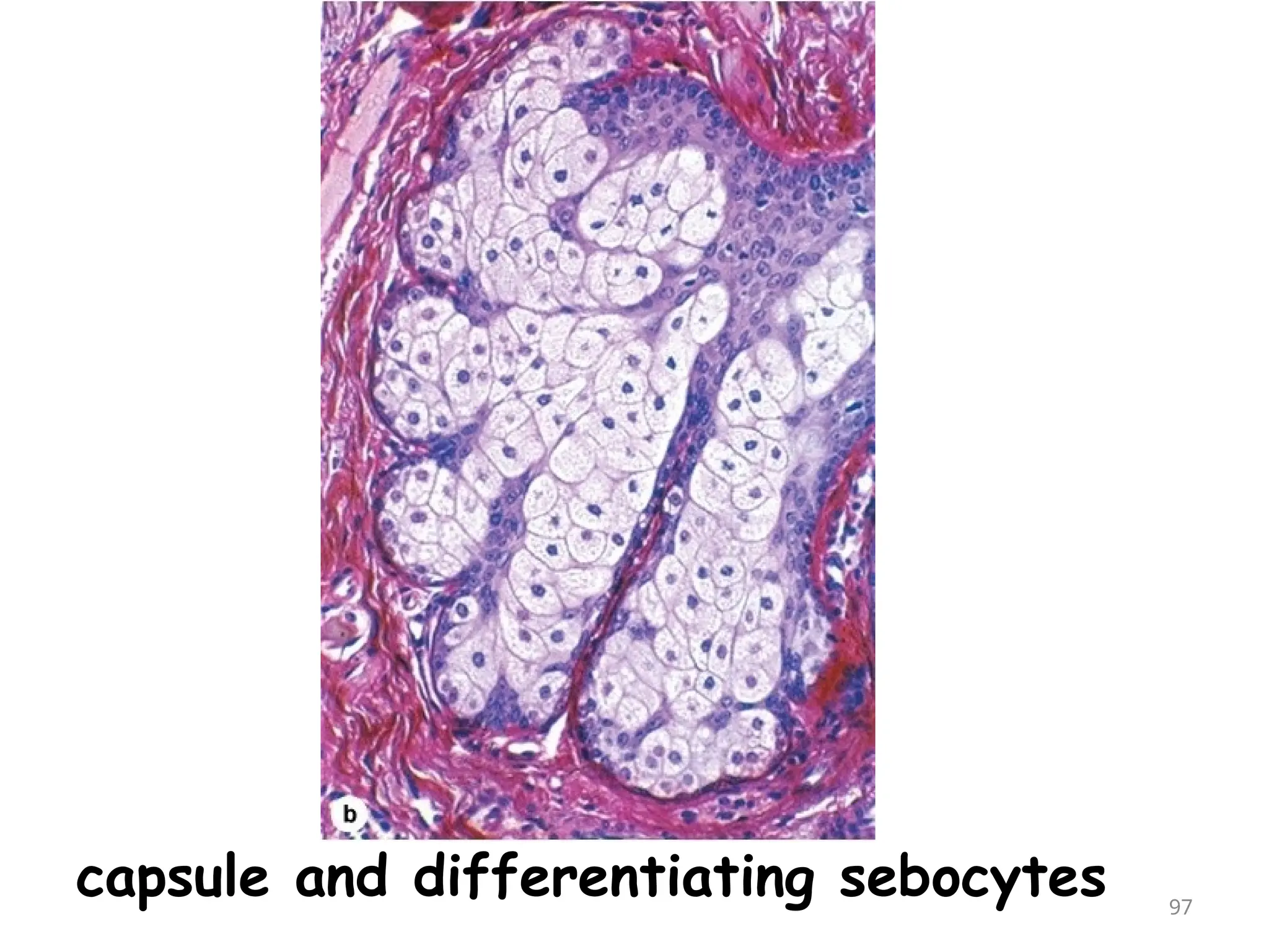 capsule and differentiating sebocytes 97
 
