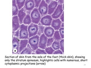 Section of skin from the sole of the foot (thick skin), showing
only the stratum spinosum, highlights cells with numerous, short
cytoplasmic projections (arrow) 24
 