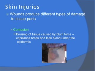 Skin Injuries
⦿ Wounds produce different types of damage
to tissue parts
⚫Contusion
○ Bruising of tissue caused by blunt force –
capillaries break and leak blood under the
epidermis
 