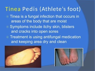 Tinea Pedis (Athlete’s foot)
⦿ Tinea is a fungal infection that occurs in
areas of the body that are moist
⦿ Symptoms include itchy skin, blisters
and cracks into open sores
⦿ Treatment is using antifungal medication
and keeping area dry and clean
 