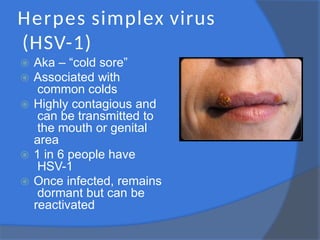 Herpes simplex virus
(HSV-1)
⦿ Aka – “cold sore”
⦿ Associated with
common colds
⦿ Highly contagious and
can be transmitted to
the mouth or genital
area
⦿ 1 in 6 people have
HSV-1
⦿ Once infected, remains
dormant but can be
reactivated
 