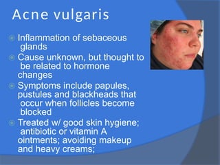 Acne vulgaris
⦿ Inflammation of sebaceous
glands
⦿ Cause unknown, but thought to
be related to hormone
changes
⦿ Symptoms include papules,
pustules and blackheads that
occur when follicles become
blocked
⦿ Treated w/ good skin hygiene;
antibiotic or vitamin A
ointments; avoiding makeup
and heavy creams;
 