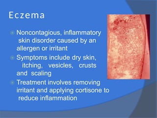 Eczema
⦿ Noncontagious, inflammatory
skin disorder caused by an
allergen or irritant
⦿ Symptoms include dry skin,
itching, vesicles, crusts
and scaling
⦿ Treatment involves removing
irritant and applying cortisone to
reduce inflammation
 