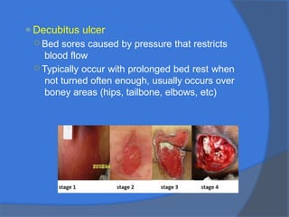⚫Decubitus ulcer
○ Bed sores caused by pressure that restricts
blood flow
○ Typically occur with prolonged bed rest when
not turned often enough, usually occurs over
boney areas (hips, tailbone, elbows, etc)
 