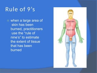 Rule of 9’s
⦿ when a large area of
skin has been
burned, practitioners
use the “rule of
nine’s” to estimate
the extent of tissue
that has been
burned
 