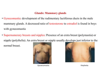 Glands: Mammary glands
• Gynecomastia: development of the rudimentary lactiferous ducts in the male
mammary glands. A decreased ratio of testosterone to estradiol is found in boys
with gynecomastia
• Supernumerary breasts and nipples: Presence of an extra breast (polymastia) or
nipple (polythelia). An extra breast or nipple usually develops just inferior to the
normal breast.
Polythelia
Gynaecomastia
 