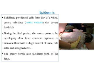 Epidermis
• Exfoliated peridermal cells form part of a white,
greasy substance (vernix caseosa) that covers
fetal skin
• During the fetal period, the vernix protects the
developing skin from constant exposure to
amniotic fluid with its high content of urine, bile
salts, and sloughed cells.
• The greasy vernix also facilitates birth of the
fetus.
 