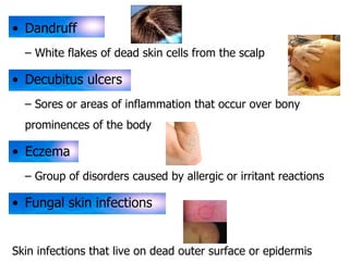 • Dandruff 
– White flakes of dead skin cells from the scalp 
• Decubitus ulcers 
– Sores or areas of inflammation that occur over bony 
prominences of the body 
• Eczema 
– Group of disorders caused by allergic or irritant reactions 
• Fungal skin infections 
Skin infections that live on dead outer surface or epidermis 
 